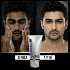 Zit Blocker & Acne Defense Face Wash